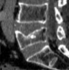 After Image