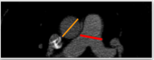 After Image